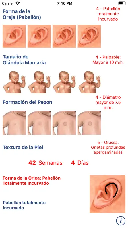 Neonatología: Método Capurro screenshot 2 of 4