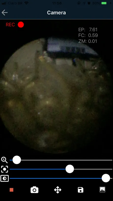 M-Scope - Mobile Endoscope