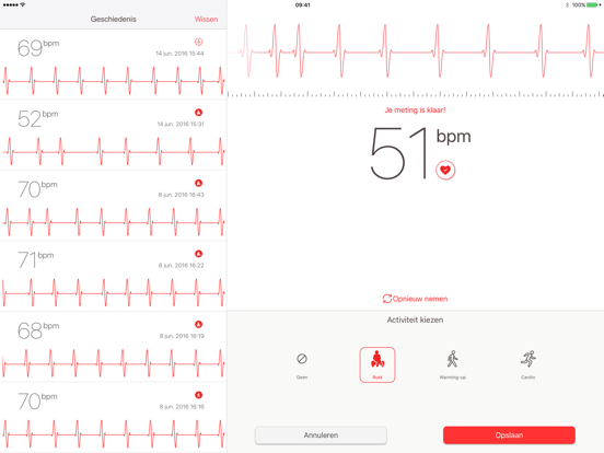 Cardiograaf iPad app afbeelding 2