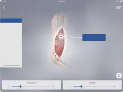 3D Spasticity iPad image 1