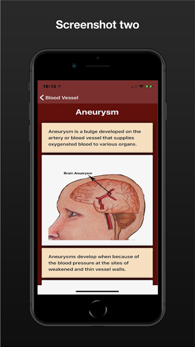 Screenshot #2 pour Neuro Surgery SPp