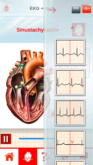 ECGinMotion screenshot 3