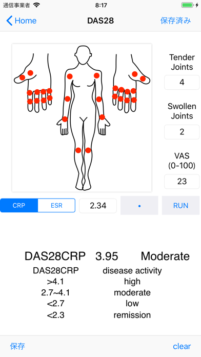 DAS28/ACR-EULAR criteriaのおすすめ画像1