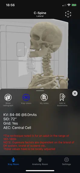 Game screenshot iRad Xrays apk