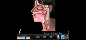 Sinus ID screenshot #4 for iPhone