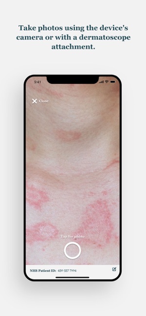 DMCTelederm(圖4)-速報App