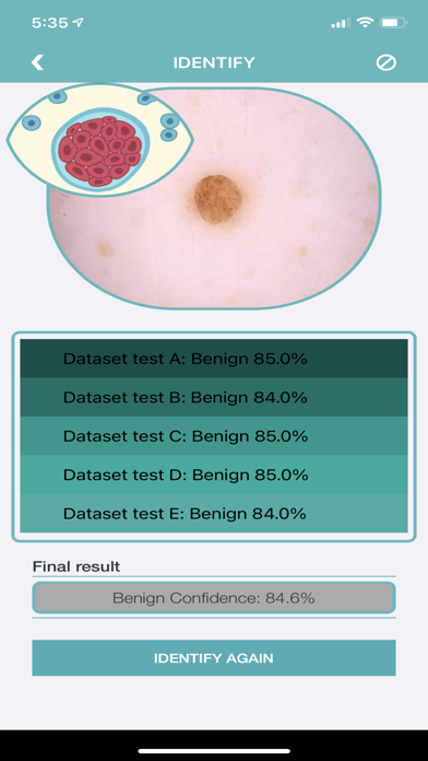 Mole Checker Skin Dermatology Screenshot