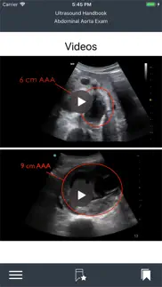 emergency ultrasound handbook iphone screenshot 4