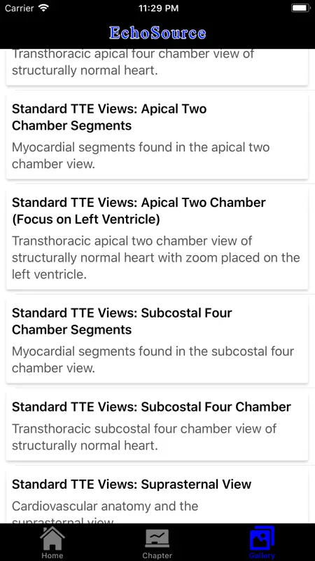 EchoSource screenshot 2 of 4