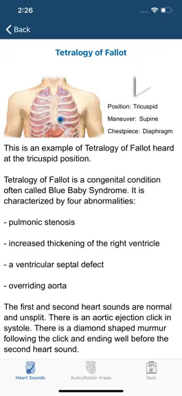 Game screenshot Heart Sounds Auscultation hack