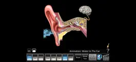 Game screenshot Ear Disorders: Outer Middle hack