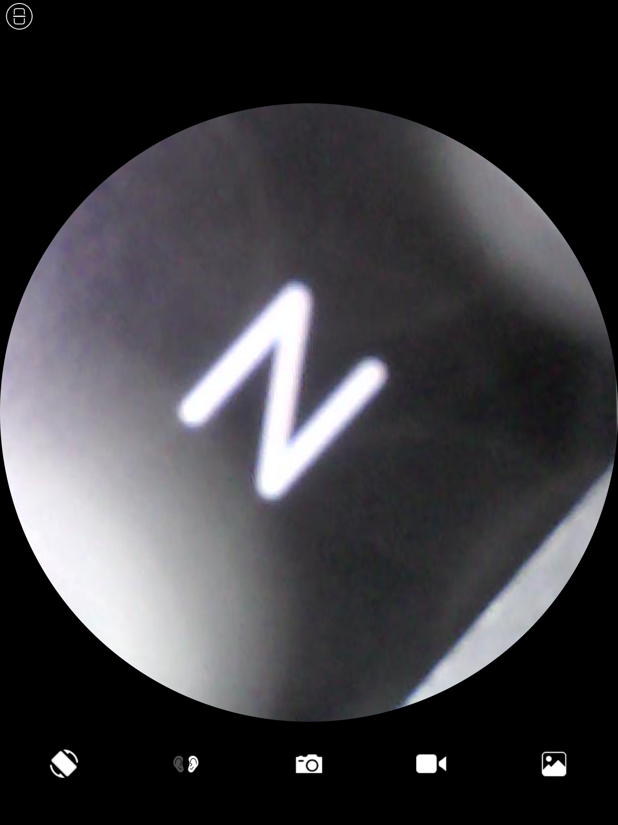 Otoscope Camera