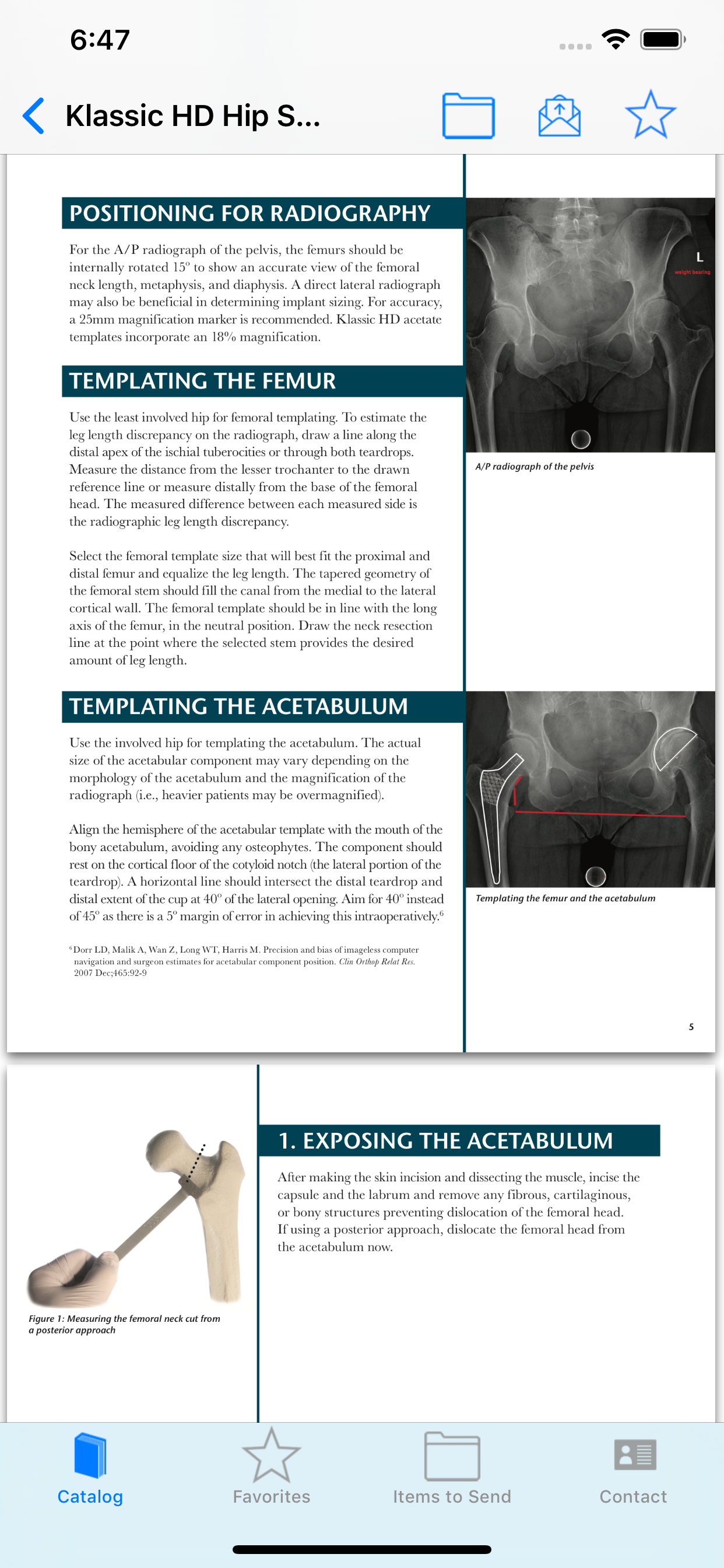 Total Joint Orthopedics