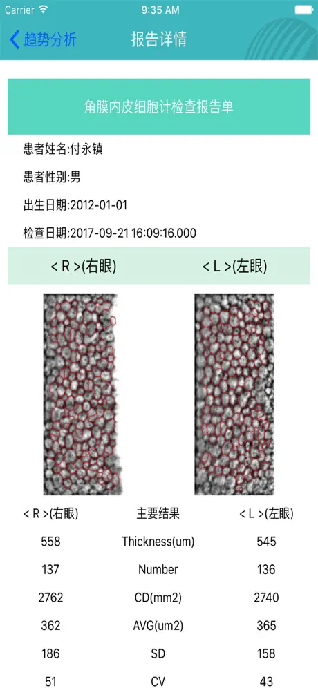眼健康