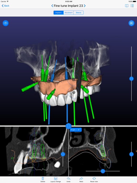 Screenshot #4 pour ICX-MagellanX