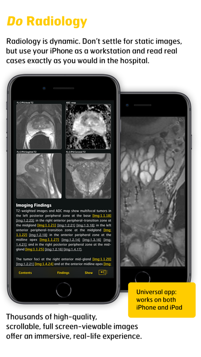 Screenshot #3 pour MR Imaging in Prostate Cancer