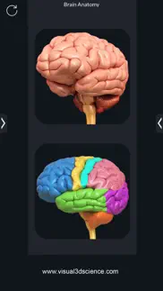 my brain anatomy iphone resimleri 2