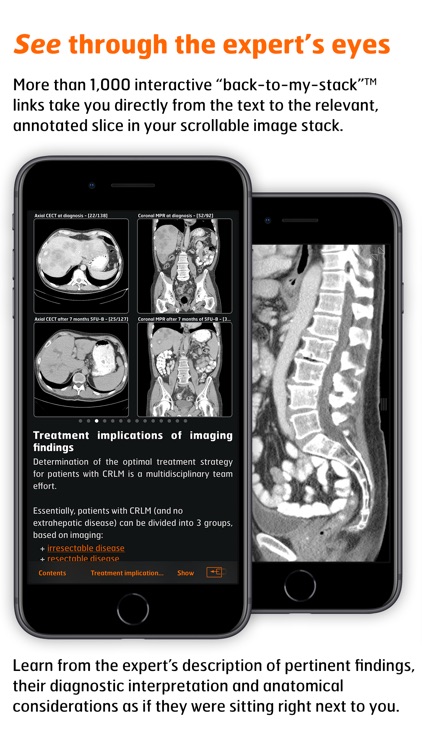Radiology - CRC Staging Atlas screenshot-3