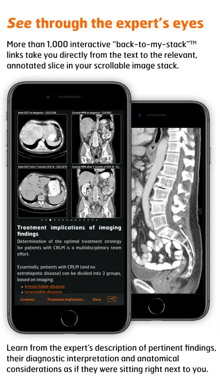 Radiology - CRC Staging Atlas screenshot 4 of 5