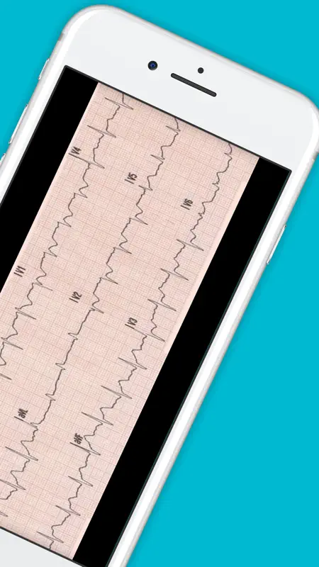 12 Lead ECG Challenge screenshot 7 of 7