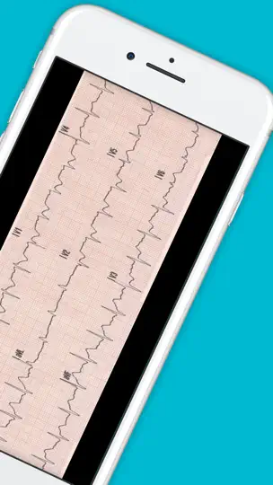 12 Lead ECG Challenge iPhone Screenshot 7