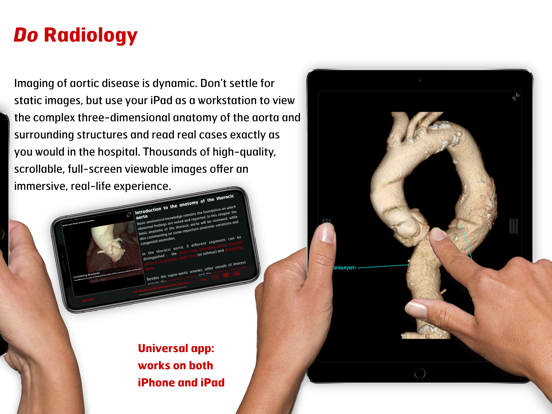 Screenshot #6 pour Radiology - Aortic Imaging