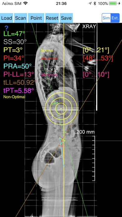 SpinopelvicBalanceAppのおすすめ画像4