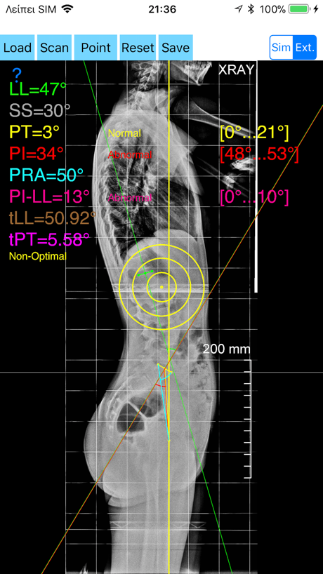 SpinopelvicBalanceApp App Store screenshot 4