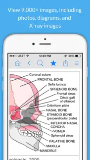 nursing dictionary by farlex iphone screenshot 3