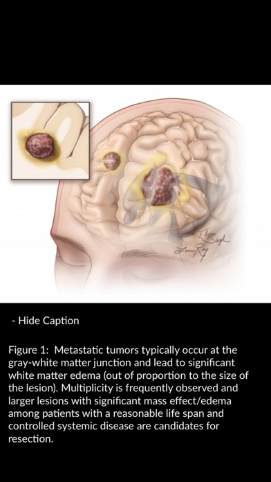 Neurosurgical Atlas Screenshot