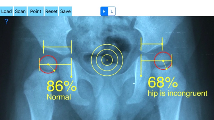 CongruityIndex screenshot-0
