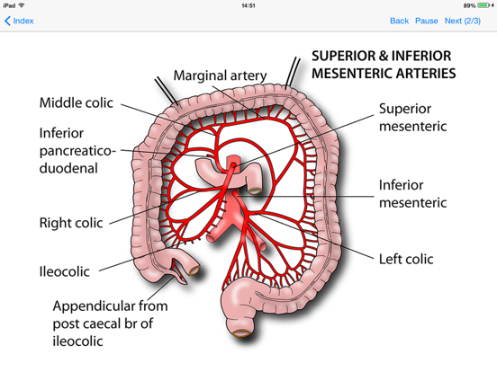 Screenshot #6 pour Tricky Areas of Anatomy