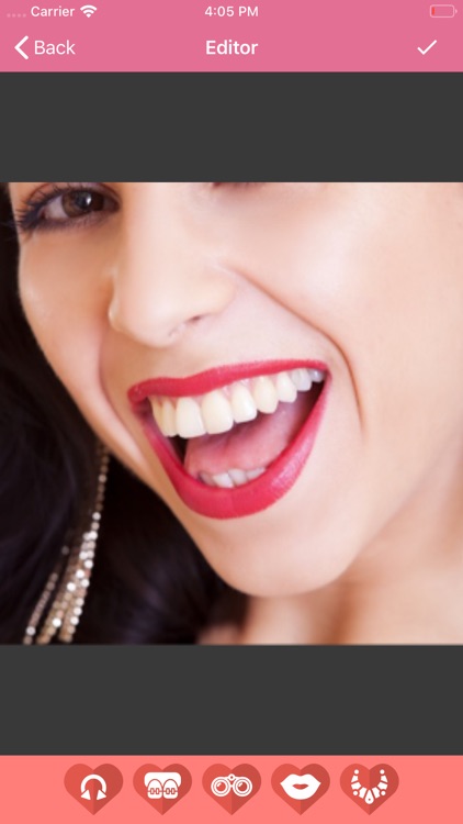 Piercing - Teeth Braces on Fac