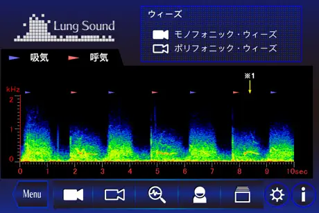 肺の聴診トレーニング - 見える肺音