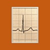 Pocket ECG