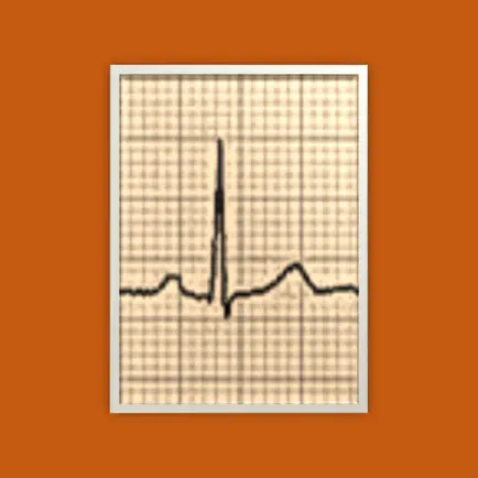 Pocket ECG Cheats