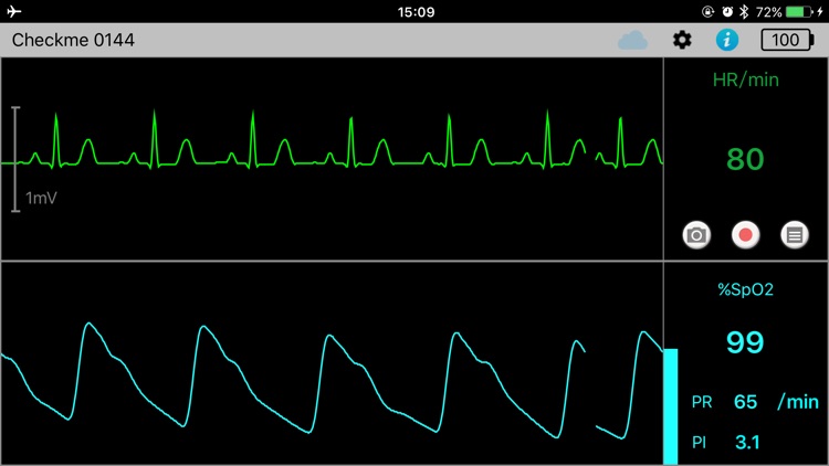 チェックモニタ