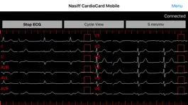 Game screenshot CardioCard Mobile apk