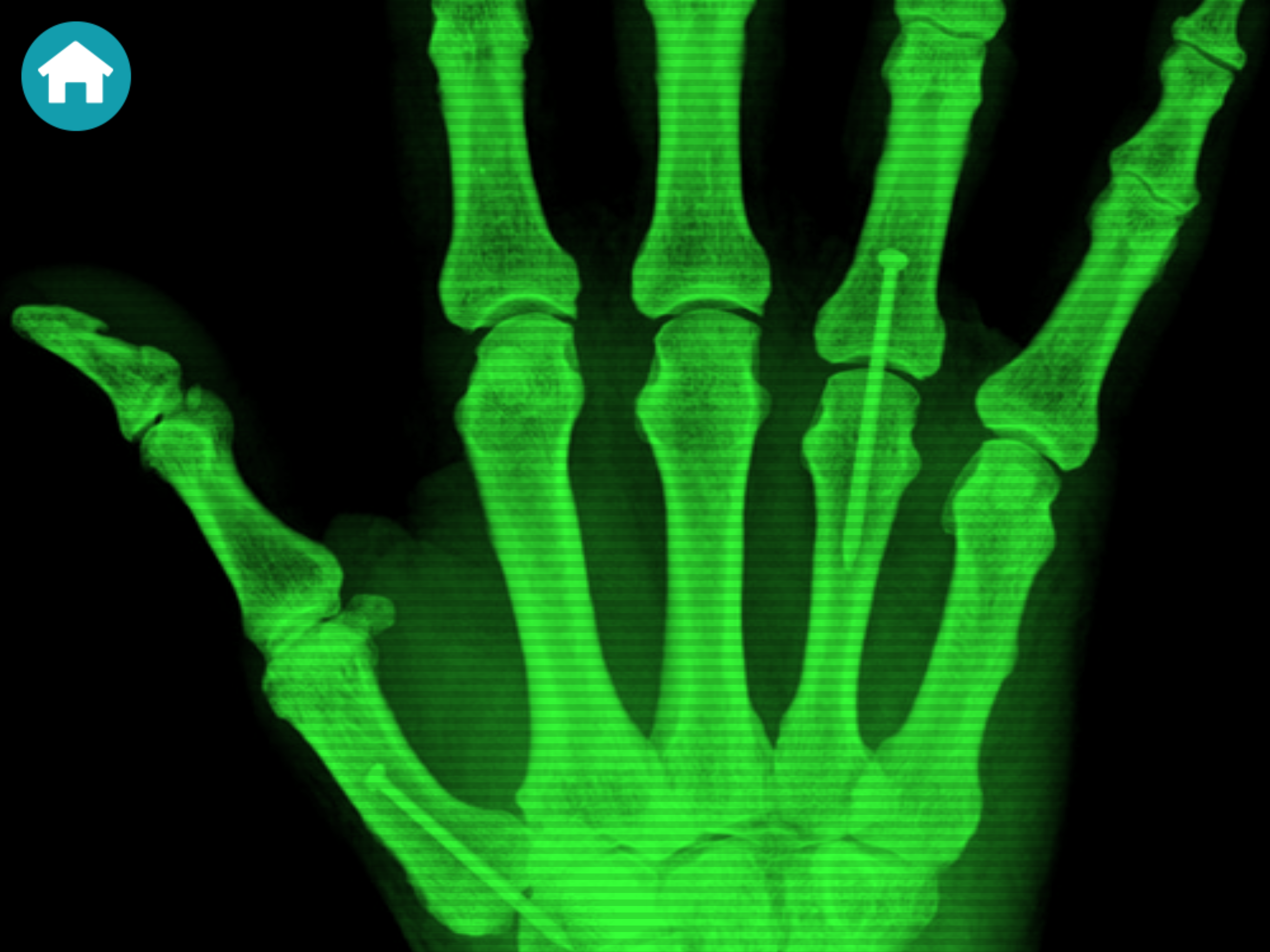 X-Ray Scanner Simulator Prank screenshot 12