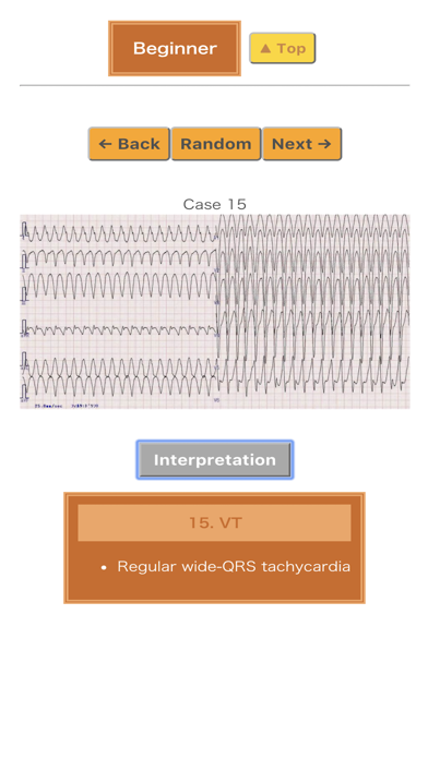 Screenshot #3 pour Pocket ECG