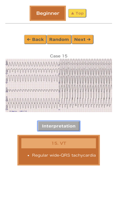 Pocket ECGのおすすめ画像3