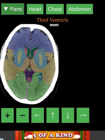 Anatomy on Radiology CTのおすすめ画像4