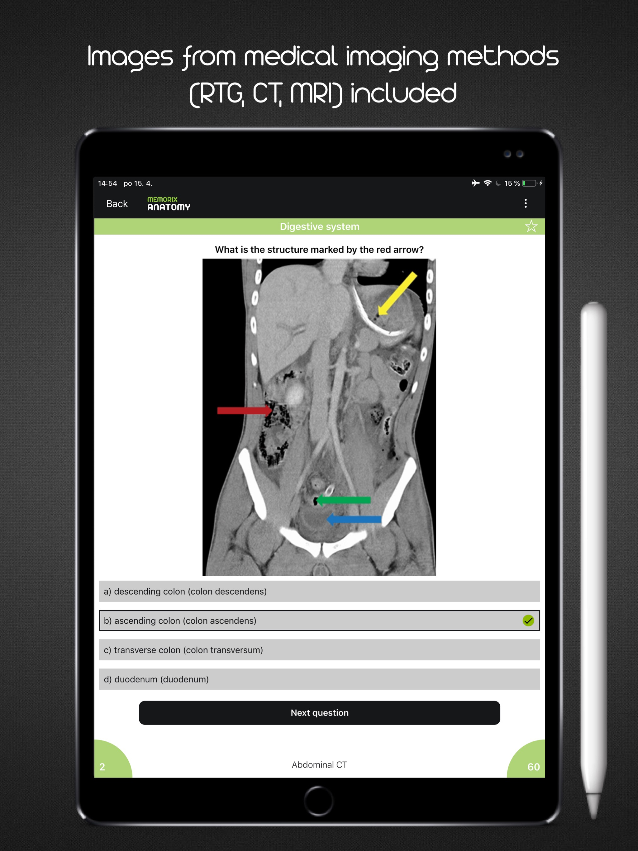 Memorix Anatomy QUIZ screenshot 8