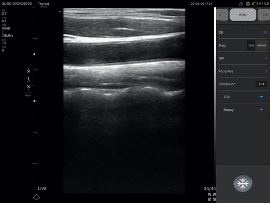 mVUE iPad screenshot 1 - Medical app