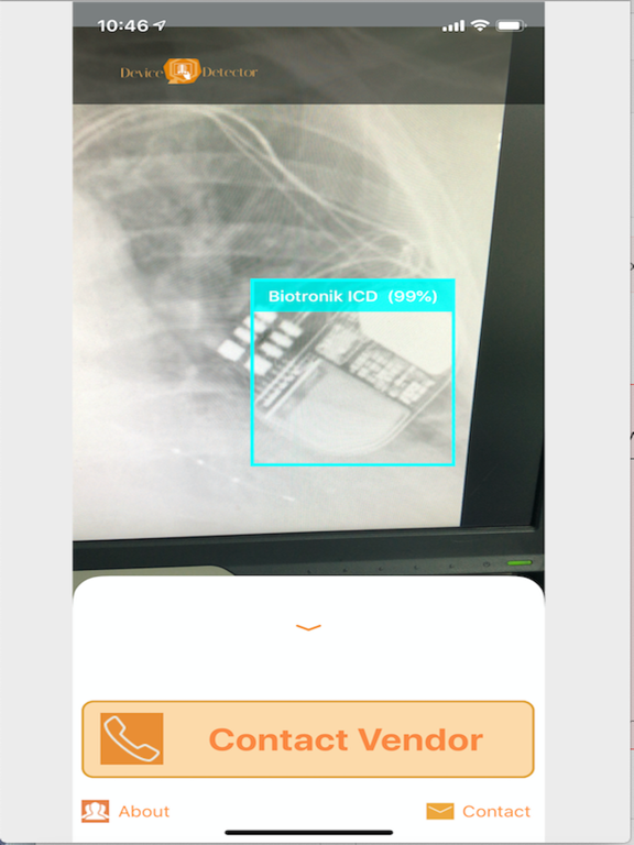Screenshot #4 pour Device Detector