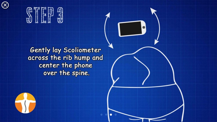 Scoliometer screenshot-4