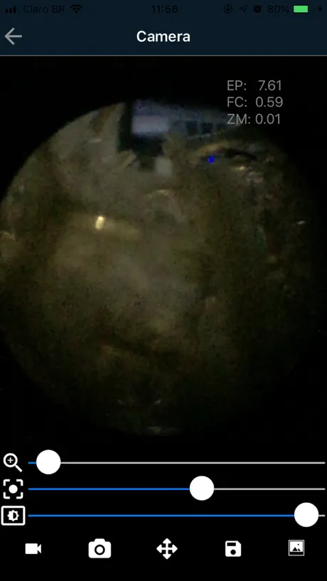 M-Scope - Mobile Endoscope