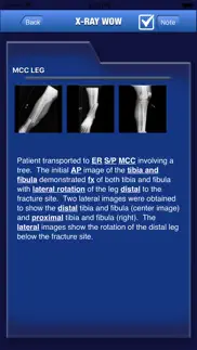 x-ray wow iphone images 4