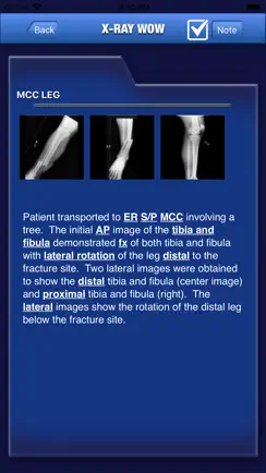 X-Ray Wow iPhone image 4