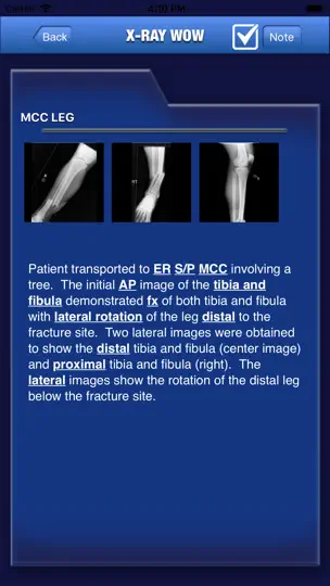 X-Ray Wow iPhone Screenshot 4